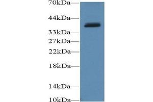 Detection of UCP4 in Porcine Cerebrum lysate using Polyclonal Antibody to Uncoupling Protein 4, Mitochondrial (UCP4) (SLC25A27 antibody  (AA 21-317))