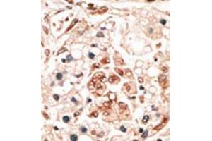 Image no. 2 for anti-Hippocalcin (HPCA) (N-Term) antibody (ABIN357112) (Hippocalcin antibody  (N-Term))