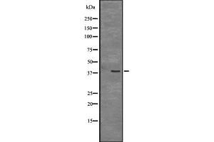 Western blot analysis of CD109 expression in Mouse cerebellum tissue lysate ,The lane on the left is treated with the antigen-specific peptide. (CD109 antibody  (C-Term))