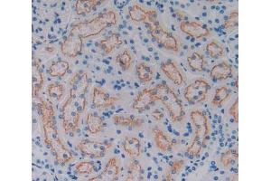 Used in DAB staining on fromalin fixed paraffin- embedded kidney tissue (CD320 antibody  (AA 36-256))