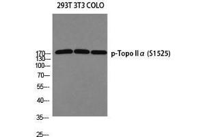 Western Blot (WB) analysis of 293T 3T3 COLO205 using p-Topo IIalpha (S1525) antibody. (Topo IIalpha (pSer1525) antibody)