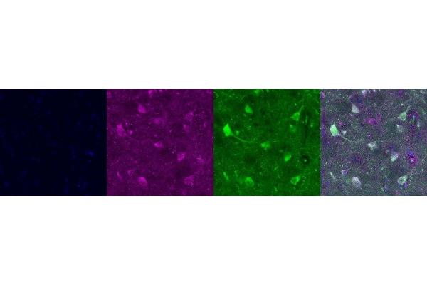 NECAB1 antibody