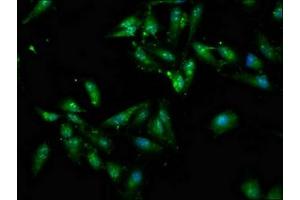 Immunofluorescence (IF) image for anti-ATPase, Cu++ Transporting, alpha Polypeptide (ATP7A) (AA 257-488) antibody (ABIN7148551)