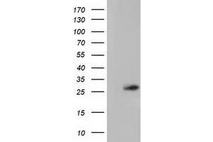 Western Blotting (WB) image for anti-OTU Domain, Ubiquitin Aldehyde Binding 2 (OTUB2) antibody (ABIN1499940)
