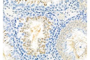 ABIN6260299 and ABIN6277920 at 1/100 staining Rat testis tissue by IHC-P. (BSP antibody  (Internal Region))
