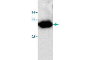 Western blot analysis in Trx tagged fusion protein with Trx tag monoclonal antibody, clone 0641a  at 1 : 1000 dilution. (Trx Tag (AA 1-111) antibody)