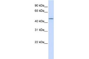 WB Suggested Anti-CHST6 Antibody Titration:  0. (CHST6 antibody  (Middle Region))