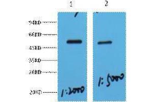 Western Blotting (WB) image for anti-Methyl CpG Binding Protein 2 (MECP2) antibody (ABIN3181262) (MECP2 antibody)