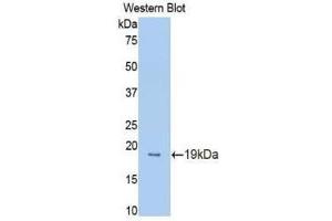 Western Blotting (WB) image for anti-Protein C Receptor, Endothelial (PROCR) (AA 32-167) antibody (ABIN1172003) (PROCR antibody  (AA 32-167))