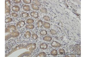 Immunoperoxidase of monoclonal antibody to NMI on formalin-fixed paraffin-embedded human small Intestine. (NMI antibody  (AA 1-100))