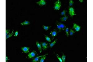 Immunofluorescent analysis of HepG2 cells using ABIN7171273 at dilution of 1:100 and Alexa Fluor 488-congugated AffiniPure Goat Anti-Rabbit IgG(H+L) (SDCBP antibody  (AA 21-228))