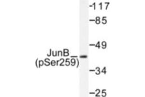 Image no. 1 for anti-Jun B Proto-Oncogene (JUNB) (pSer259) antibody (ABIN318057) (JunB antibody  (pSer259))