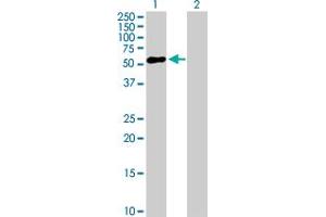 Western Blot analysis of ZNF436 expression in transfected 293T cell line by ZNF436 MaxPab polyclonal antibody. (ZNF436 antibody  (AA 1-470))