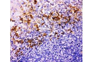 IHC-P: Integrin beta 1 antibody testing of human tonsil tissue (ITGB1 antibody  (AA 527-728))