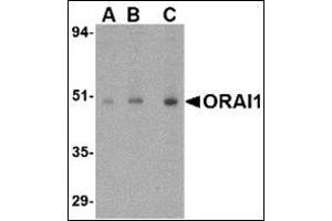 Western blot analysis of ORAI1 in human ovary tissue lysate with this product at (A) 0. (ORAI1 antibody  (C-Term))