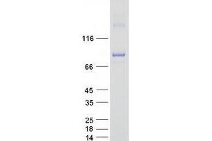 Validation with Western Blot (TBK1 Protein (Myc-DYKDDDDK Tag))
