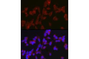 Immunofluorescence analysis of SH-SY5Y cells using A Rabbit pAb (ABIN7265712) at dilution of 1:150 (40x lens). (ATG9A antibody  (AA 180-290))