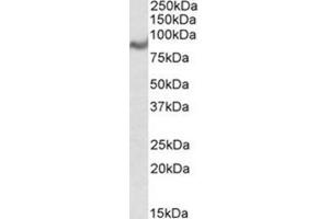 AP31058PU-N C18orf8 antibody staining of Human Breast lysate at 1 µg/ml (35µg protein in RIPA buffer).
