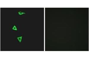 Immunofluorescence analysis of LOVO cells, using BDKRB1 Antibody. (BDKRB1 antibody  (AA 201-250))