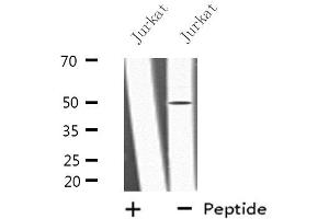 Western blot analysis of extracts from Jurkat cells, using LRP11 antibody. (LRP11 antibody  (Internal Region))