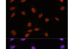 Immunofluorescence analysis of U-2 OS cells using SRSF7 Polyclonal Antibody at dilution of 1:100. (SFRS7 antibody)