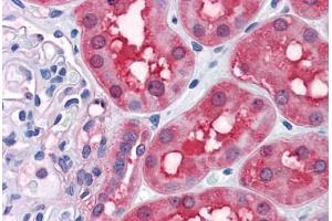 Human Kidney: Formalin-Fixed, Paraffin-Embedded (FFPE) (RRM2 antibody  (AA 1-111))