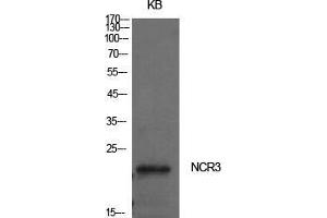 Western Blot (WB) analysis of KB cells using NKp30 Polyclonal Antibody. (NCR3 antibody  (Internal Region))