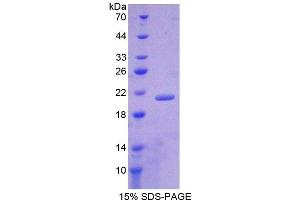 SDS-PAGE (SDS) image for Lipocalin 1 (LCN1) (AA 22-173) protein (His tag) (ABIN1878553) (Lipocalin 1 Protein (LCN1) (AA 22-173) (His tag))