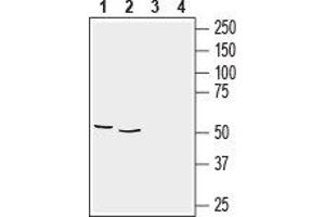 Western blot analysis of rat brain membranes (lanes 1 and 3), (1:2000) and mouse brain lysate (lanes 2 and 4), (1:400):1,2.