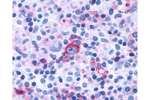 Anti-GPR97 antibody IHC of human Lymph Node, Hodgkins Lymphoma. (GPR97 antibody  (Extracellular Domain))