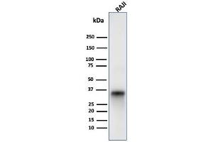 Western blot analysis of Raji cell lysate using CD74 Mouse Monoclonal Antibody (LN-2).