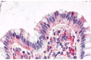 Immunohistochemistry (Formalin/PFA-fixed paraffin-embedded sections) of human colon, surface epithelium with GPR15 polyclonal antibody . (GPR15 antibody  (1st Cytoplasmic Domain))
