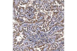 IHC analysis of TTC7B using anti-TTC7B antibody (ABIN7601050). (TTC7B antibody  (AA 275-730))
