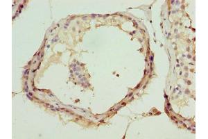 Immunohistochemistry of paraffin-embedded human testis tissue using ABIN7144998 at dilution of 1:100 (DDX55 antibody  (AA 101-400))