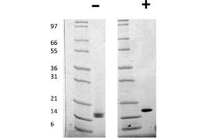 SDS-PAGE of Human Fibroblast Growth Factor acidic Recombinant Protein SDS-PAGE of Human Fibroblast Growth Factor acidic Recombinant Protein.