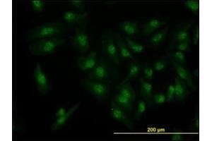 Immunofluorescence (IF) image for anti-Cyclin-Dependent Kinase 6 (CDK6) antibody (ABIN781963) (CDK6 antibody)