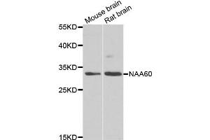 Western blot analysis of extracts of mouse brain and rat brain cell lines, using NAA60 antibody. (NAT15 antibody)