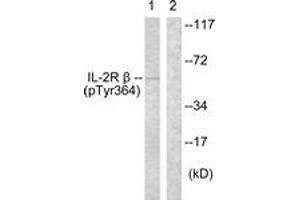 Western blot analysis of extracts from HeLa cells, using IL-2R beta (Phospho-Tyr364) Antibody.