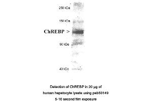 Image no. 2 for anti-MLX Interacting Protein-Like (MLXIPL) (AA 800-852), (C-Term), (Isoform 1) antibody (ABIN363458) (MLXIPL antibody  (C-Term, Isoform 1))