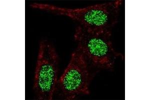Fluorescent confocal image of HeLa cells stained with KLF4 antibody at 1:100.