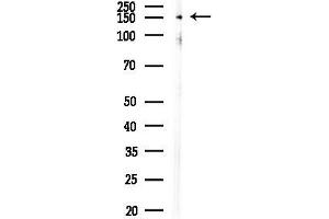 Western blot analysis of lysates from 293 cells(UV,30 min treatment), using Phospho-TAO2 (Ser181) Antibody at 1/1000 dilution.