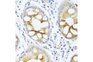 Immunohistochemistry of paraffin-embedded human colon using PRKCA antibody (ABIN5970097) at dilution of 1/100 (40x lens).