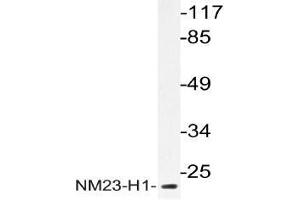 Western blot (WB) analysis of NM23-H1 antibody in extracts from HeLa cells.