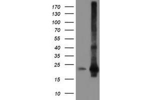 HEK293T cells were transfected with the pCMV6-ENTRY control (Left lane) or pCMV6-ENTRY SAT2 (Right lane) cDNA for 48 hrs and lysed. (SAT2 antibody)