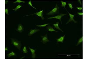 Immunofluorescence of monoclonal antibody to RING1 on HeLa cell. (RING1 antibody  (AA 81-170))
