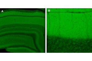 Indirect immunolabeling of PFA fixed rat hippocampus (A) and cerebellum (B) sections. (SNAP47 antibody)