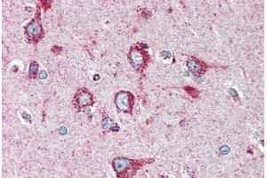 Human Brain, Cortex (formalin-fixed, paraffin-embedded) stained with SOD2 antibody ABIN396955 at 1:50 followed by biotinylated anti-mouse IgG secondary antibody ABIN481714, alkaline phosphatase-streptavidin and chromogen. (SOD2 antibody)