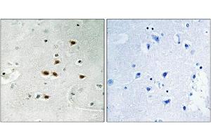 Immunohistochemical analysis of paraffin-embedded human brain tissue using ITCH (Phospho-Tyr420) antibody (left)or the same antibody preincubated with blocking peptide (right). (ITCH antibody  (pTyr420))