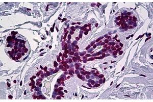 Human Breast: Formalin-Fixed, Paraffin-Embedded (FFPE) (EN1 antibody  (AA 266-392))