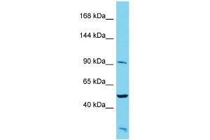Host: Rabbit Target Name: PALD1 Sample Type: HepG2 Whole Cell lysates Antibody Dilution: 1. (KIAA1274 antibody  (N-Term))